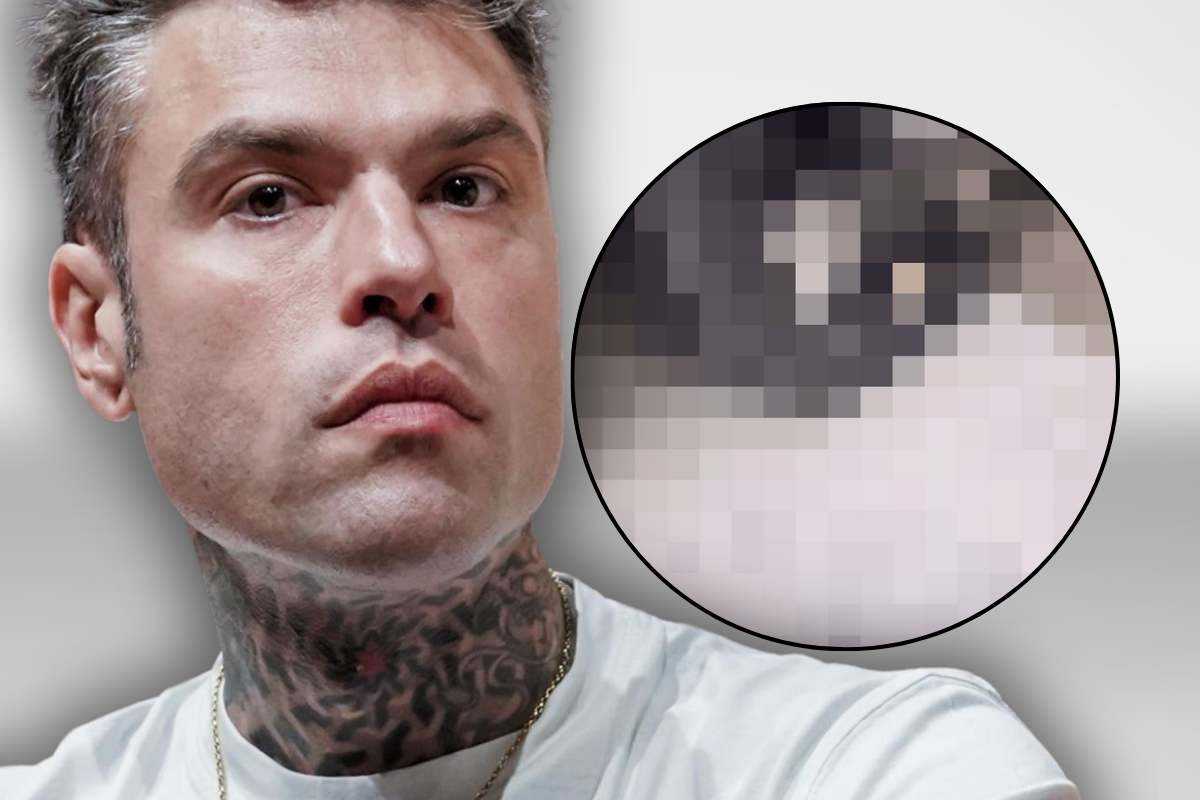 Fedez incidente grave